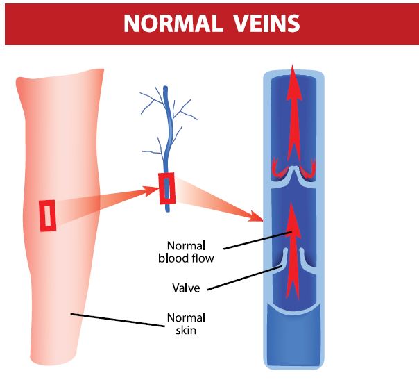 SVS Normal Vein Flow